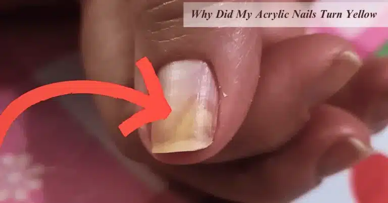 Why Did My Acrylic Nails Turn Yellow? 8 Things To Know For Prevention